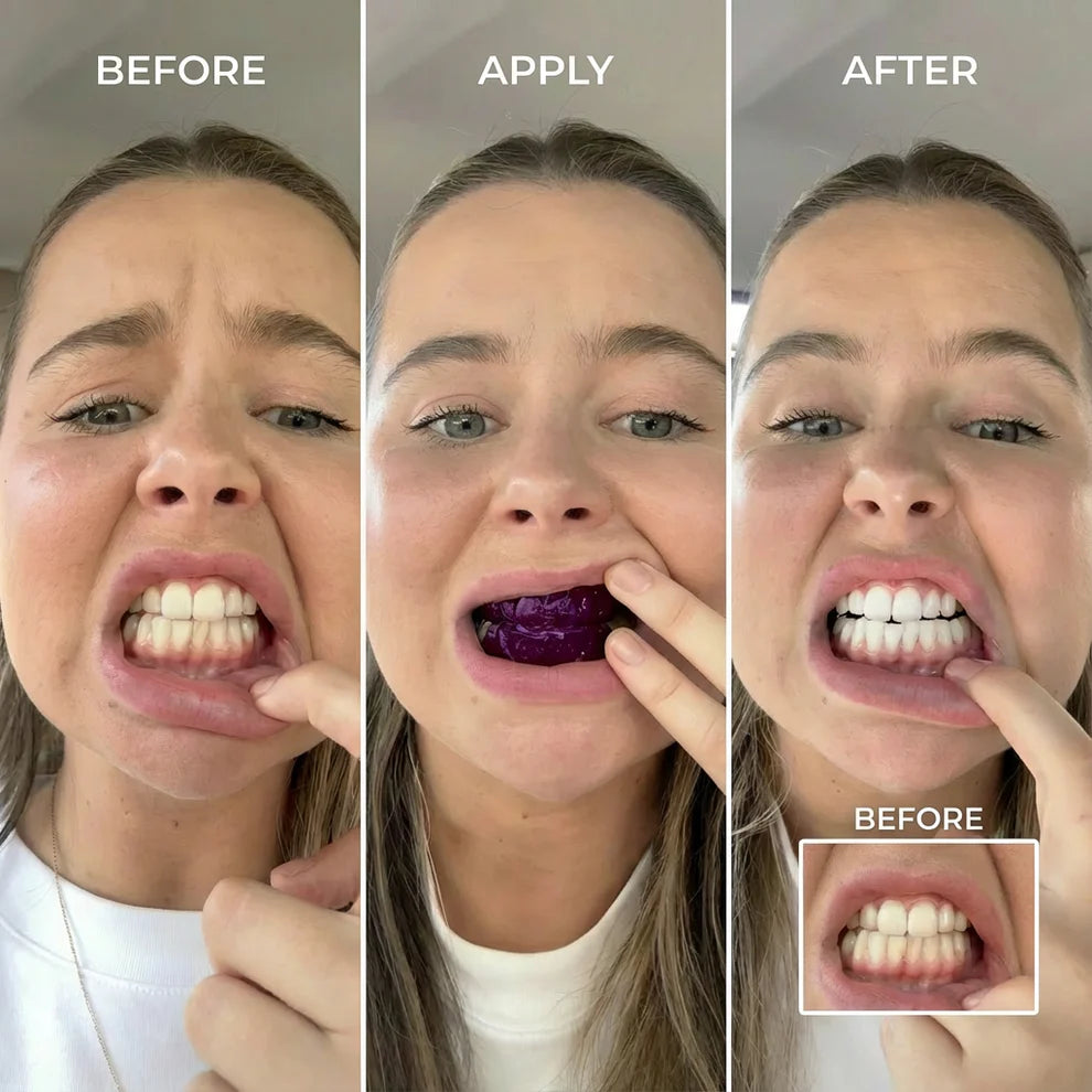 Norvella™ Purple Teeth Whitening Strips